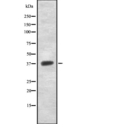 Polyclonal Rabbit anti-Human NDUFAF1 / CIA30 Antibody (IHC, WB)