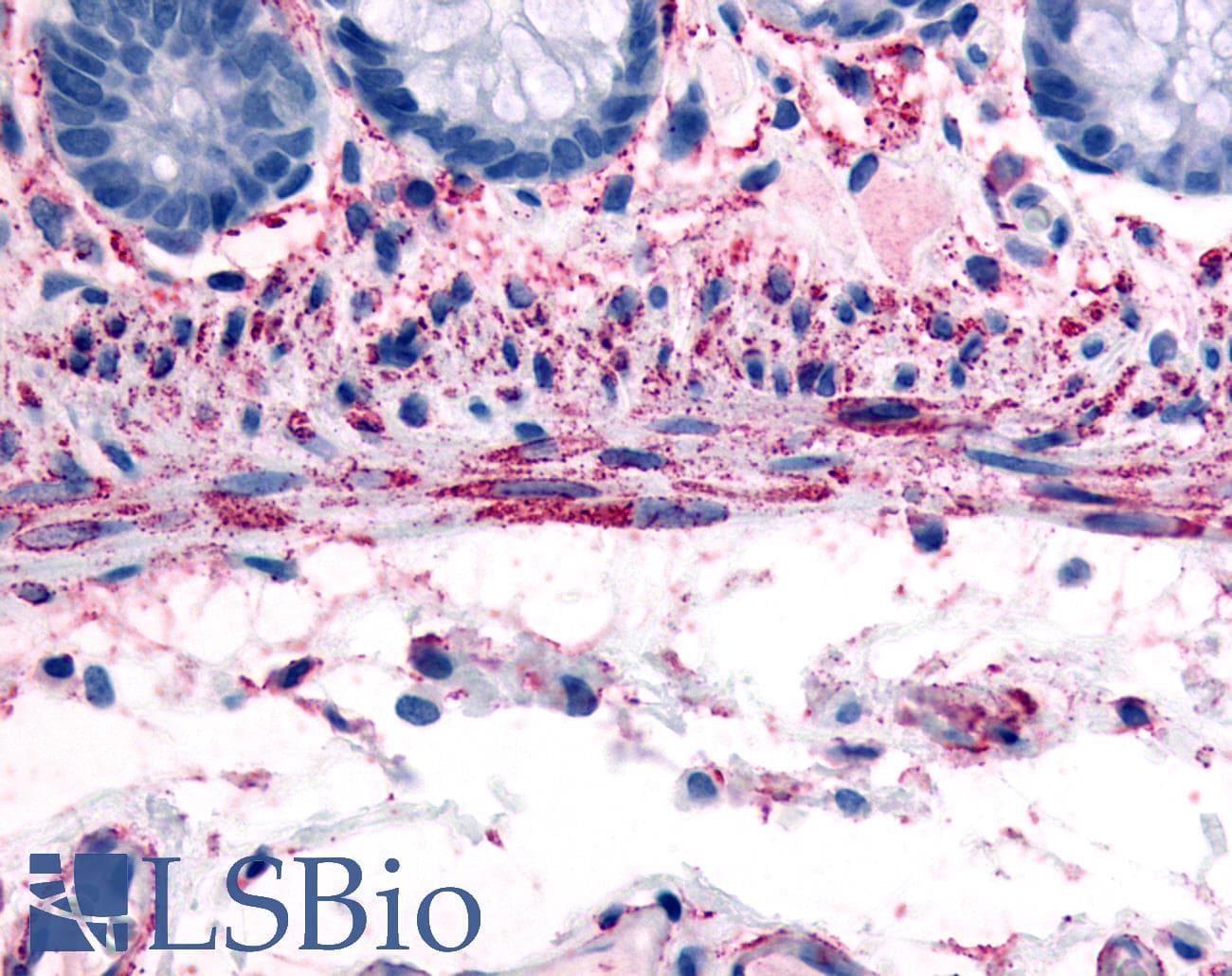 IHC-plus™ ADRA1B / Adrenoceptor alpha 1B Antibody (C-Terminus)
