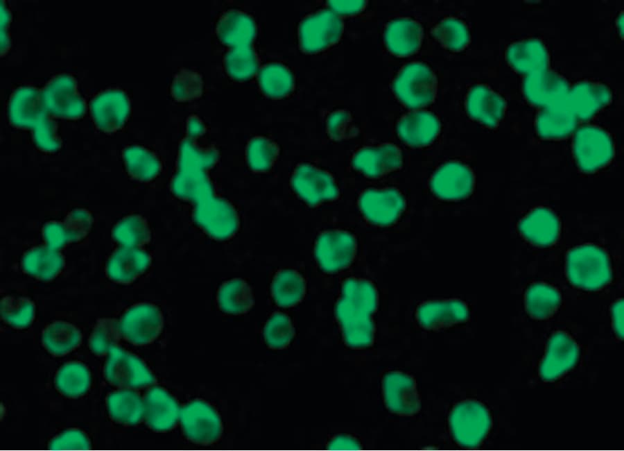 IHC-plus™ DAPK3 / ZIP Kinase Antibody
