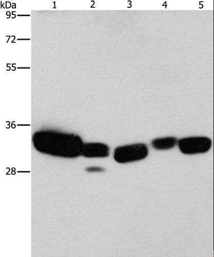 CBR / CBR1 Antibody