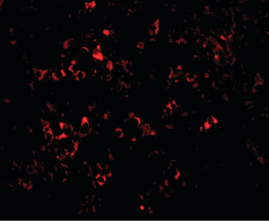 IHC-plus™ PAK2 Antibody