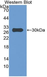 IGFBP4 Antibody (aa23-259)