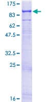 Human EXT2 Protein (Recombinant GST)