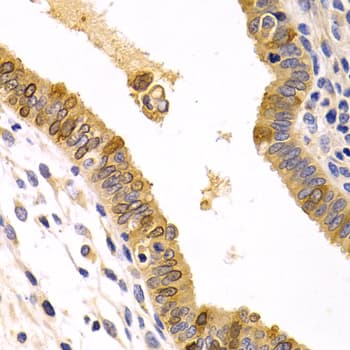 CXCR3 Antibody (aa289-368)