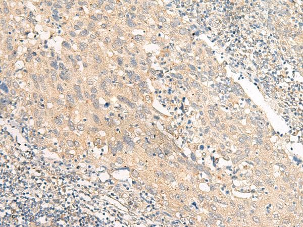 SLC9A1BP / CHP Antibody