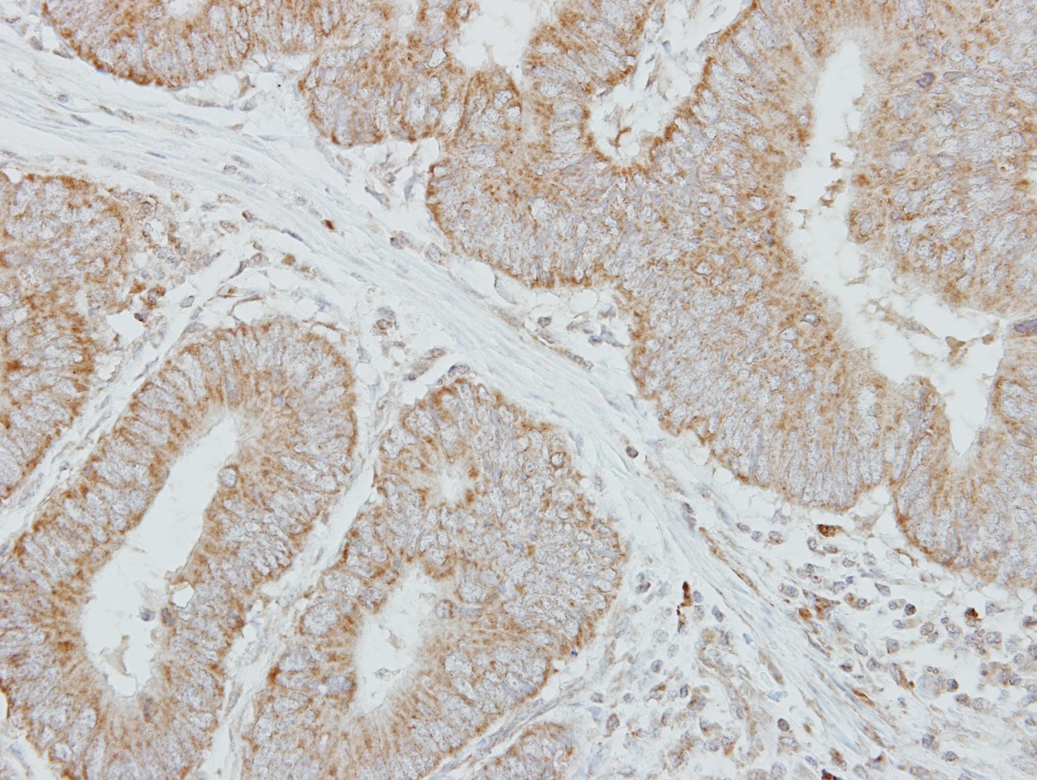 Polyclonal Rabbit anti-Human F9 / Factor IX Antibody (aa217-453, IHC, WB)