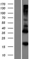 Human ADM5 / C19orf76 Protein (Over-Expression Lysate Myc-DDK (Flag))