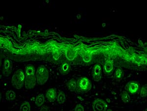 RAB5 Antibody (APC)