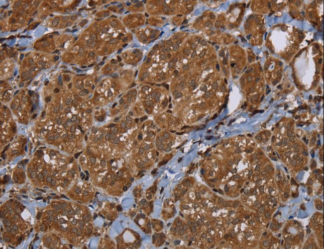 HSD17B4 Antibody