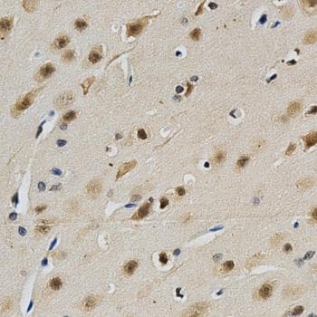 LGALS3 / Galectin 3 Antibody