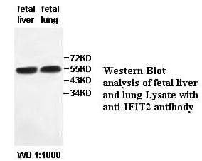 ISG54 / IFIT2 Antibody (aa100-321)