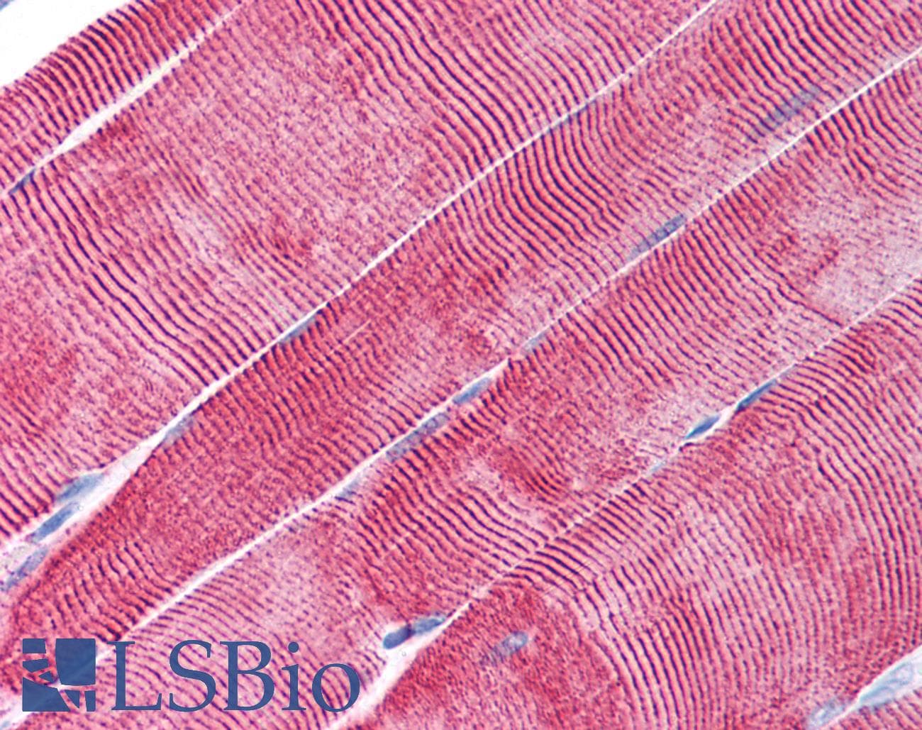 IHC-plus™ Monoclonal Mouse anti-Human DES / Desmin Antibody (clone 10H7D2, IHC, WB)