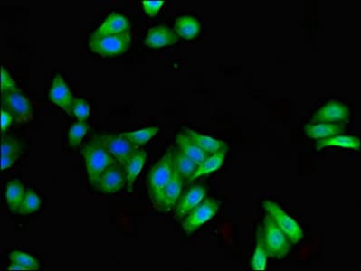 Polyclonal Rabbit anti-Human FILIP1 Antibody (IHC, IF)