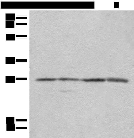 Polyclonal Rabbit anti-Human COMT Antibody (IHC, WB)