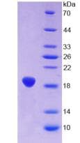 Rat GFAP Protein (Recombinant His-S)