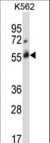 CBLC Antibody (aa424-453)