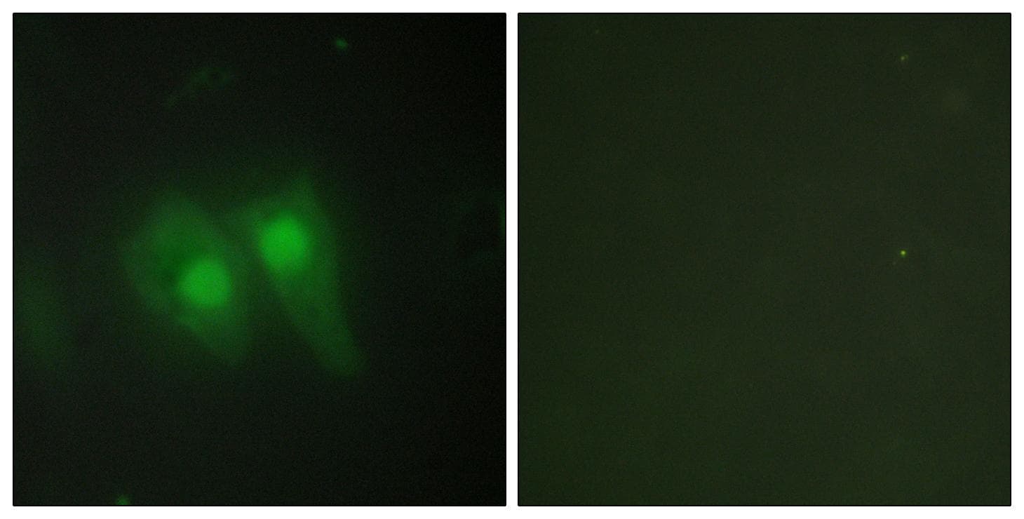 Polyclonal Rabbit anti-Human TSAP6 / STEAP3 Antibody (IF, WB)