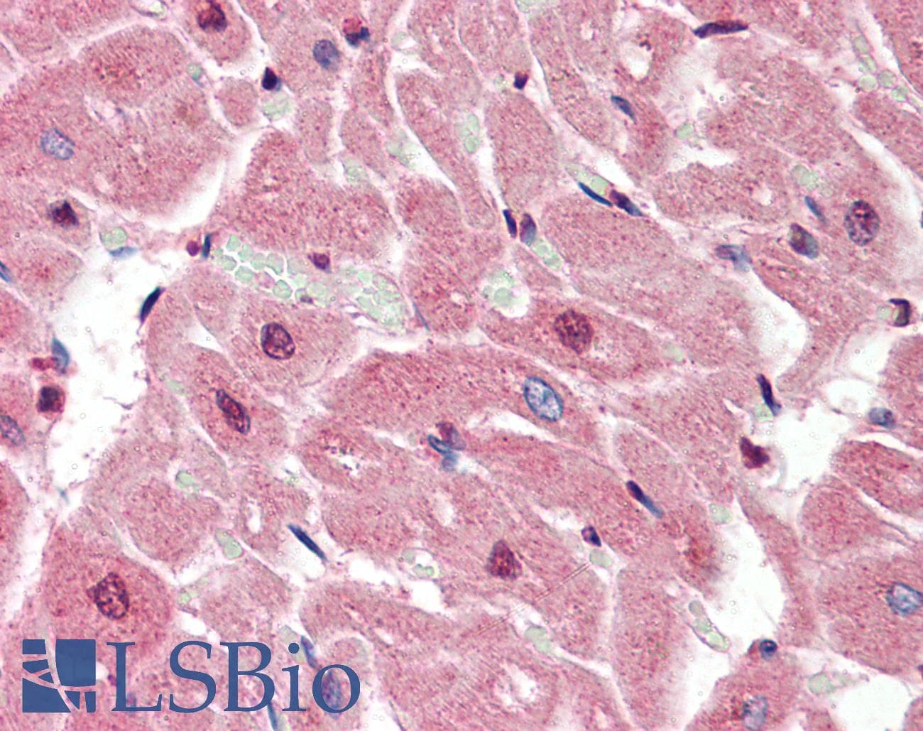 IHC-plus™ Polyclonal Rabbit anti-Human SIRT2 / Sirtuin 2 Antibody (IHC, IF, WB)