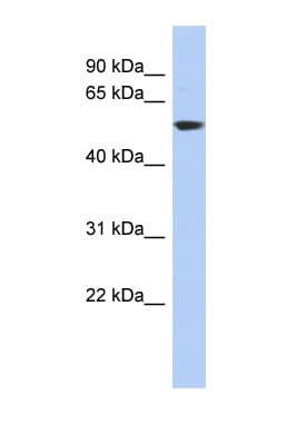 Polyclonal Rabbit anti-Human GLUD1/Glutamate Dehydrogenase Antibody (aa71-120, WB)