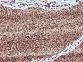 Monoclonal Mouse anti-Human LCMT1 Antibody (clone OTI2C9, IHC, WB)