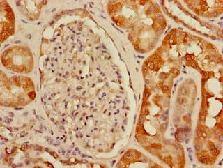 Polyclonal Rabbit anti-Human USHBP1 Antibody