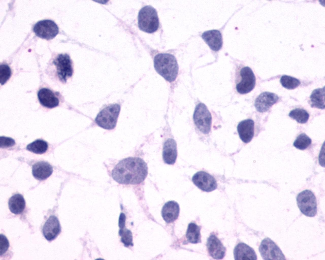 PathPlus™ GPR44 / CRTH2 Antibody (N-Terminus)