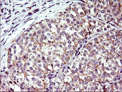 TOLLIP Antibody (clone OTI2A4)