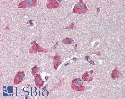 PathPlus™ Polyclonal Rabbit anti-Human ACHE / Acetylcholinesterase Antibody (IHC, WB)