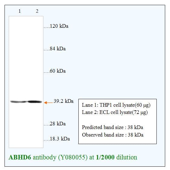 Polyclonal Rabbit anti-Human ABHD6 Antibody (WB)