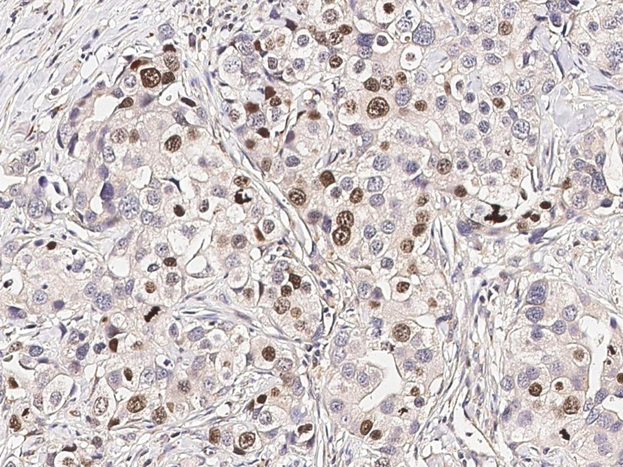RARB / RAR Beta Antibody (Preservative Free)