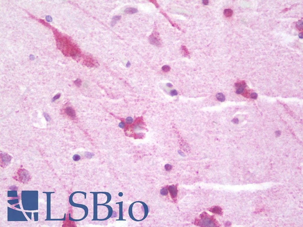 IHC-plus™ Polyclonal Rabbit anti-Human CLASP1 Antibody (aa1171-1220, IHC, WB)