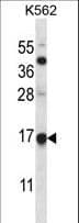 Polyclonal Rabbit anti-Human MAGOH Antibody (aa46-74, IHC, WB)