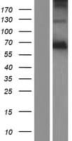 AOAH / Acyloxyacyl Hydrolase Protein (Over-Expression Lysate Myc-DDK (Flag))