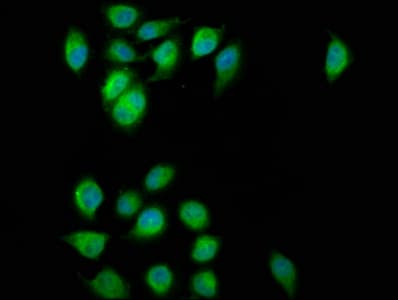 ESYT2 / E-Syt2 Antibody