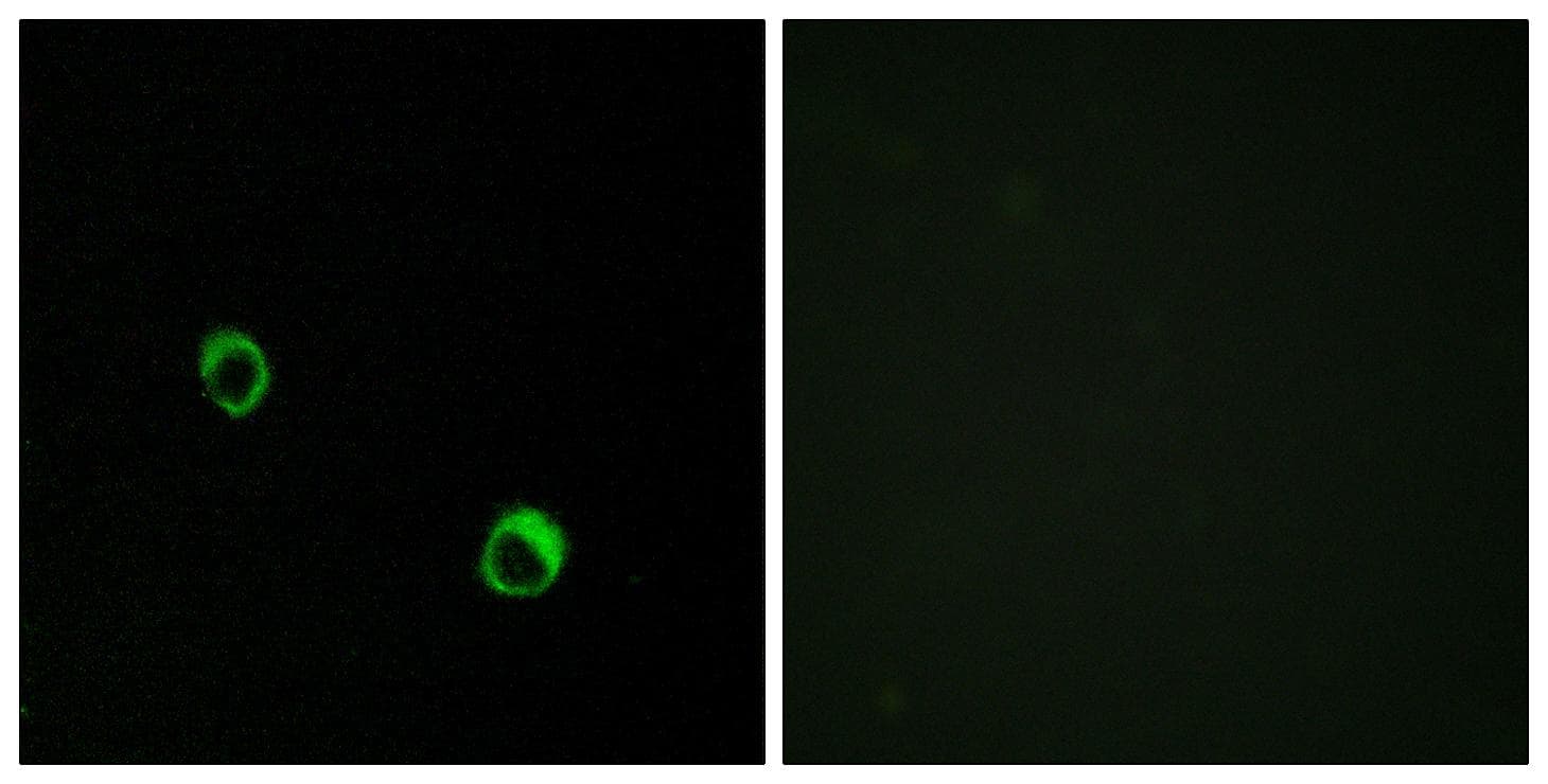 CARD14 Antibody