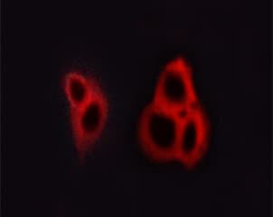 GRIN1 / NMDAR1 Antibody (phospho-Ser890)