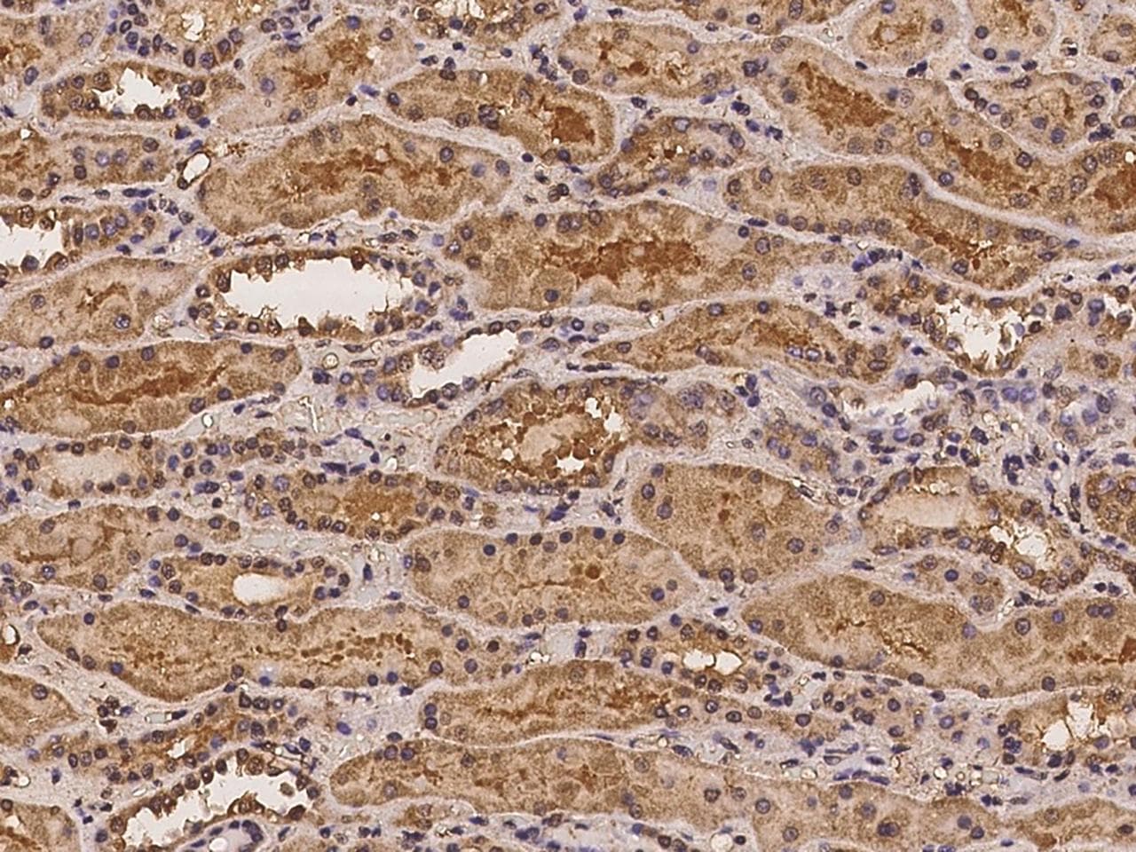ADAM23 Antibody
