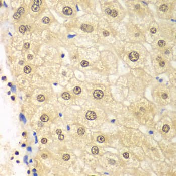 Polyclonal Rabbit anti-Human PSMD2 Antibody (IHC, IF, WB)