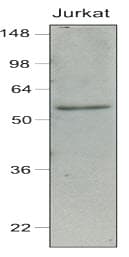 IHC-plus™ IRF7 Antibody (aa1-150, clone 3D9)