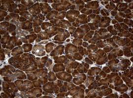 NME1 / NM23 Antibody (clone OTI4H2)