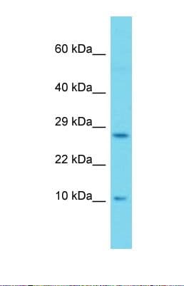 SH2D1A / SAP Antibody (aa52-101)