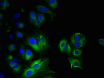MYADM / Myeloid Marker BM-1 Antibody