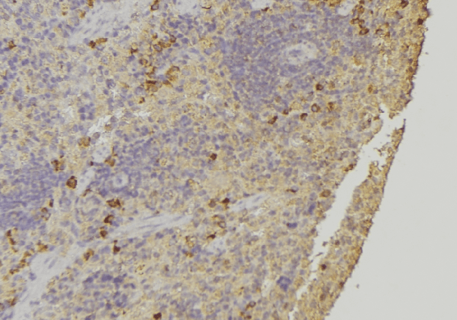 ARHGAP1 / CDC42GAP Antibody