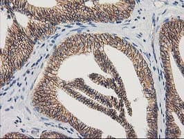 CTNNB1 / Beta Catenin Antibody (clone OTI12H7)