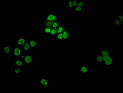 HIST1H1E Antibody (phospho-Thr3)