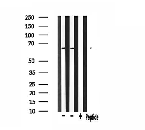 CALR / Calreticulin Antibody