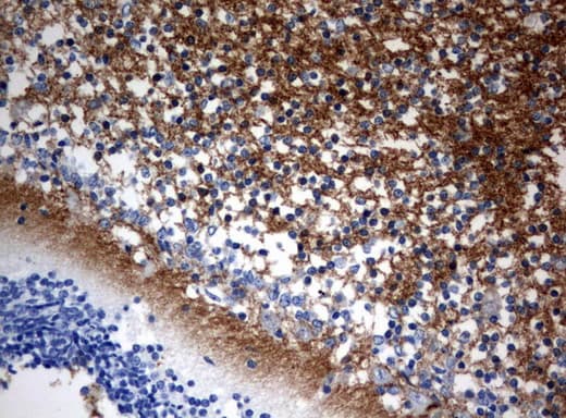 VILIP / VSNL1 Antibody (aa2-191, clone UMAB116, Carrier-free)