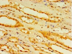 DCP2 Antibody (aa1-385)
