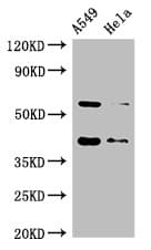 SMN1 Antibody