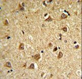 DIO2 Antibody (aa165-191)
